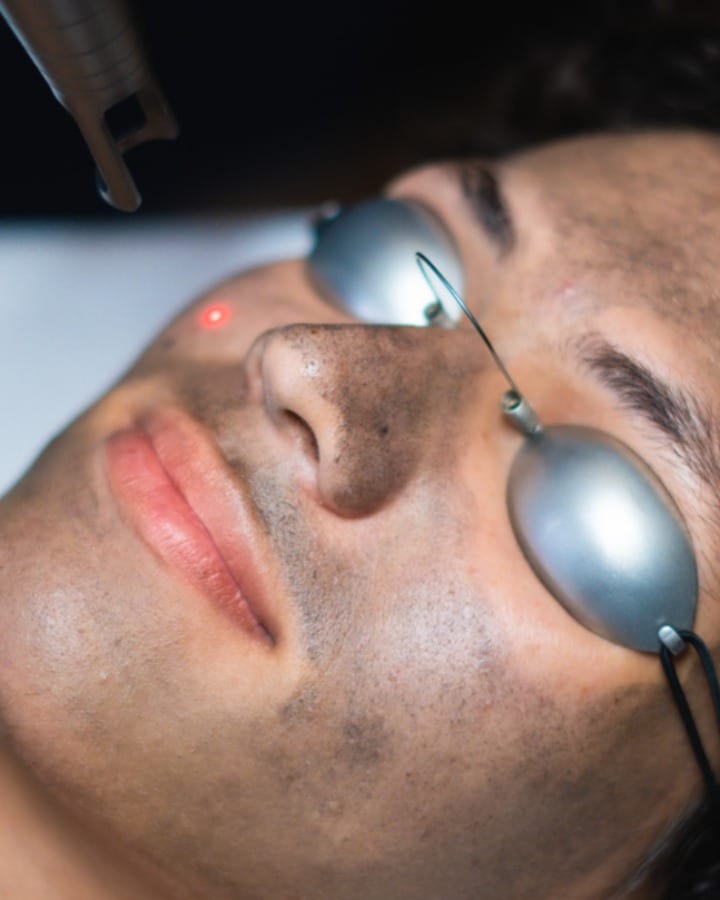 Remedy Skin Care hollywood laser facial